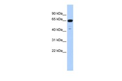 Aviva Systems Biology Corp TRIM72 Antibody - N-terminal region (ARP42970_P050)