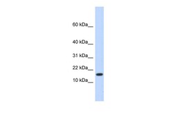 Aviva Systems Biology Corp HERC4 Antibody - N-terminal region (ARP42990_P050)