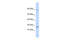 Aviva Systems Biology Corp HERC4 Antibody - middle region (ARP42991_P050)