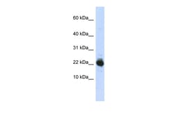 Aviva Systems Biology Corp UBE2L3 Antibody - middle region (ARP43023_P050)