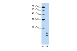 Aviva Systems Biology Corp UBE2L3 Antibody - C-terminal region (ARP43026_P050)