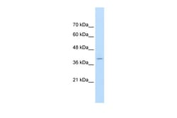 Aviva Systems Biology Corp FKBP6 Antibody - middle region (ARP43027_T100)