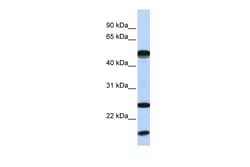 Aviva Systems Biology Corp UBE2L6 Antibody - N-terminal region (ARP43033_P050)