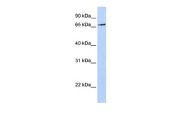 Aviva Systems Biology Corp RNF139 Antibody - N-terminal region (ARP43092_P050)