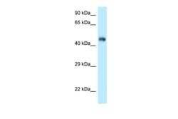 Aviva Systems Biology Corp Fbxl3 Antibody - C-terminal region (ARP43099_P050)