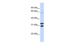 Aviva Systems Biology Corp FBXO24 Antibody - N-terminal region (ARP43115_P050)