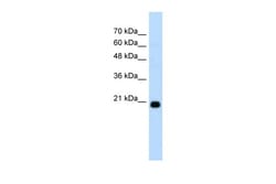 Aviva Systems Biology Corp FBXO25 Antibody - C-terminal region (ARP43118_T100)