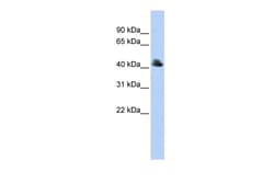 Aviva Systems Biology Corp FBXO4 Antibody - middle region (ARP43122_P050)
