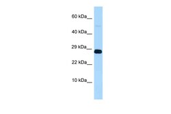 Aviva Systems Biology Corp RNF11L ANTIBODY 50UG/50UL, Quantity: Each of