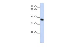 Aviva Systems Biology Corp ZNF364 Antibody - C-terminal region (ARP43154_P050)