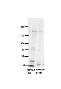 Aviva Systems Biology Corp ZNF294 Antibody - N-terminal region (ARP43201_P050)