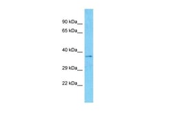 Aviva Systems Biology Corp MARCH5 Antibody - N-terminal region (ARP43232_P050)