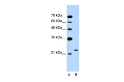 Aviva Systems Biology Corp C14orf130 Antibody - C-terminal region (ARP43243_T100)