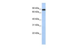 Aviva Systems Biology Corp CHFR Antibody - N-terminal region (ARP43250_P050)
