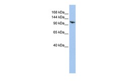 Aviva Systems Biology Corp RNF20 Antibody - N-terminal region (ARP43264_P050)