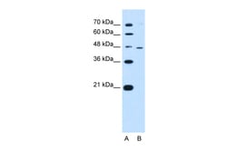 Aviva Systems Biology Corp RNF25 Antibody - middle region (ARP43300_P050)