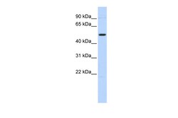 Aviva Systems Biology Corp TRIM55 Antibody - N-terminal region (ARP43372_P050)