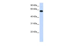 Aviva Systems Biology Corp FBXO24 Antibody - middle region (ARP43378_P050)