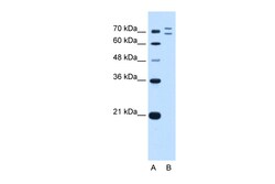 Aviva Systems Biology Corp RNF168 Antibody - C-terminal region (ARP43433_P050)