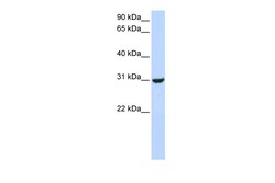 Aviva Systems Biology Corp RNF182 Antibody - middle region (ARP43439_P050)