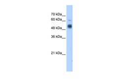 Aviva Systems Biology Corp GCNT3 Antibody - C-terminal region (ARP43526_T100)