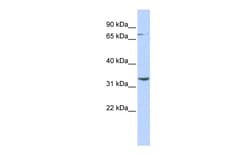 Aviva Systems Biology Corp DPY19L1 Antibody - N-terminal region (ARP43554_P050)