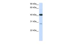 Aviva Systems Biology Corp GCDH Antibody - N-terminal region (ARP43568_P050)