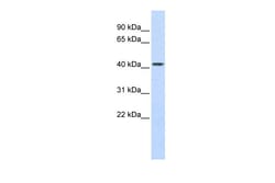 Aviva Systems Biology Corp CPB2 Antibody - middle region (ARP43570_P050)