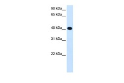 Aviva Systems Biology Corp ADH4 Antibody - middle region (ARP43573_T100)