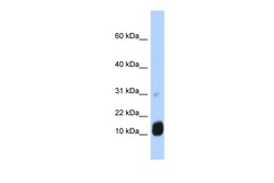 Aviva Systems Biology Corp GCHFR Antibody - N-terminal region (ARP43574_P050)