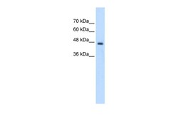 Aviva Systems Biology Corp PCYT2 Antibody - C-terminal region (ARP43576_T100)
