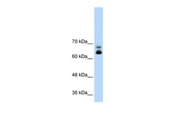 Aviva Systems Biology Corp MTA2 Antibody - C-terminal region (ARP43599_T100)