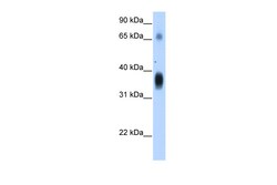 Aviva Systems Biology Corp NOV Antibody - middle region (ARP43612_T100)