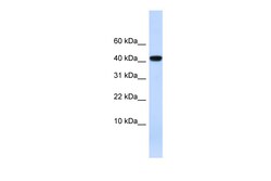 Aviva Systems Biology Corp AGT Antibody - N-terminal region (ARP43614_P050)