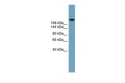 Aviva Systems Biology Corp ABCA12 Antibody - middle region (ARP43683_P050)