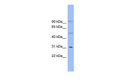 Aviva Systems Biology Corp SLC25A25 Antibody - N-terminal region (ARP43763_P050)