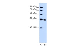 Aviva Systems Biology Corp SLC25A29 Antibody - C-terminal region (ARP43788_T100)