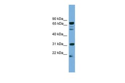 Aviva Systems Biology Corp SLC6A3 Antibody - N-terminal region (ARP43791_P050)