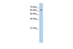 Aviva Systems Biology Corp SLC38A1 Antibody - middle region (ARP43811_T100)