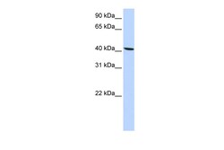 Aviva Systems Biology Corp SLC22A18 Antibody - N-terminal region (ARP43825_P050)