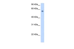 Aviva Systems Biology Corp SLC1A4 Antibody - C-terminal region (ARP43827_P050)