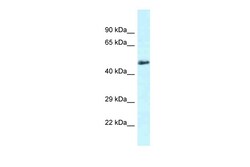 Aviva Systems Biology Corp Slc1a4 Antibody - C-terminal region (ARP43828_P050)