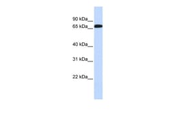 Aviva Systems Biology Corp SLC6A1 Antibody - middle region (ARP43834_P050)