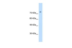 Aviva Systems Biology Corp SLC7A1 Antibody - N-terminal region (ARP43838_P050)