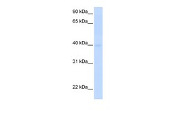 Aviva Systems Biology Corp SLC25A36 Antibody - N-terminal region (ARP43984_P050)