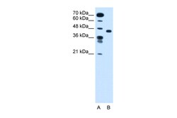 Aviva Systems Biology Corp SLC35C1 Antibody - N-terminal region (ARP43989_T100)