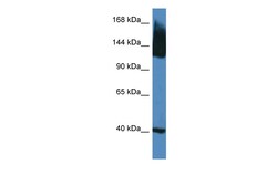 Aviva Systems Biology Corp Slc12a5 Antibody - N-terminal region (ARP44012_P050)