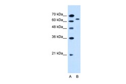 Aviva Systems Biology Corp SLC22A3 Antibody - N-terminal region (ARP44026_P050)
