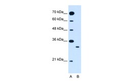Aviva Systems Biology Corp SLC25A22 Antibody - N-terminal region (ARP44041_T100)