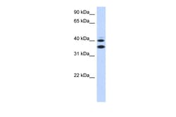 Aviva Systems Biology Corp SLC25A32 Antibody - middle region (ARP44050_P050)